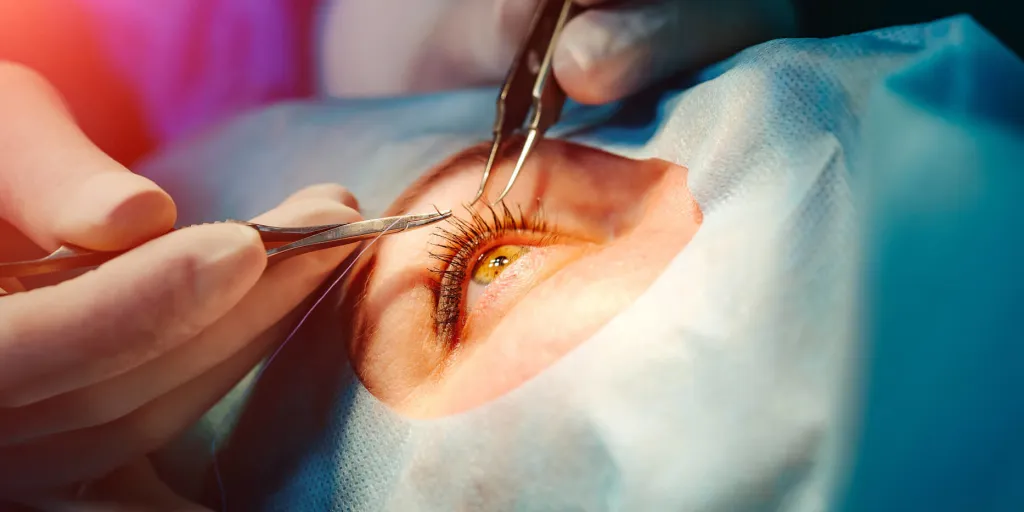 cirugía de ojo en mujer